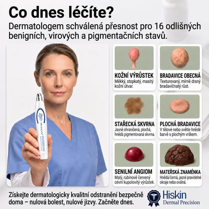 🥰Oficiální značkový obchod | Hiskin® 7denní odstraňovač skvrn a pigmentových skvrn (Bezbolestný rollerball bez jizev)🐬