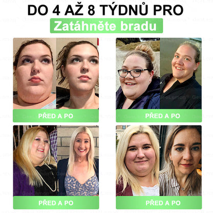 𝐆𝐞𝑒𝑙𝑒𝐦𝐨𝐧®🤞 Glum𝐚𝐬𝐞tide 8 v 1 – Zeštíhlující nano mikrojihlový náplast 🇨🇿 Jen 1× denně ✅ Viditelné změny za 7 dní – na obezitu, kardiovaskulární zdraví, diabetes a kloubní problémy