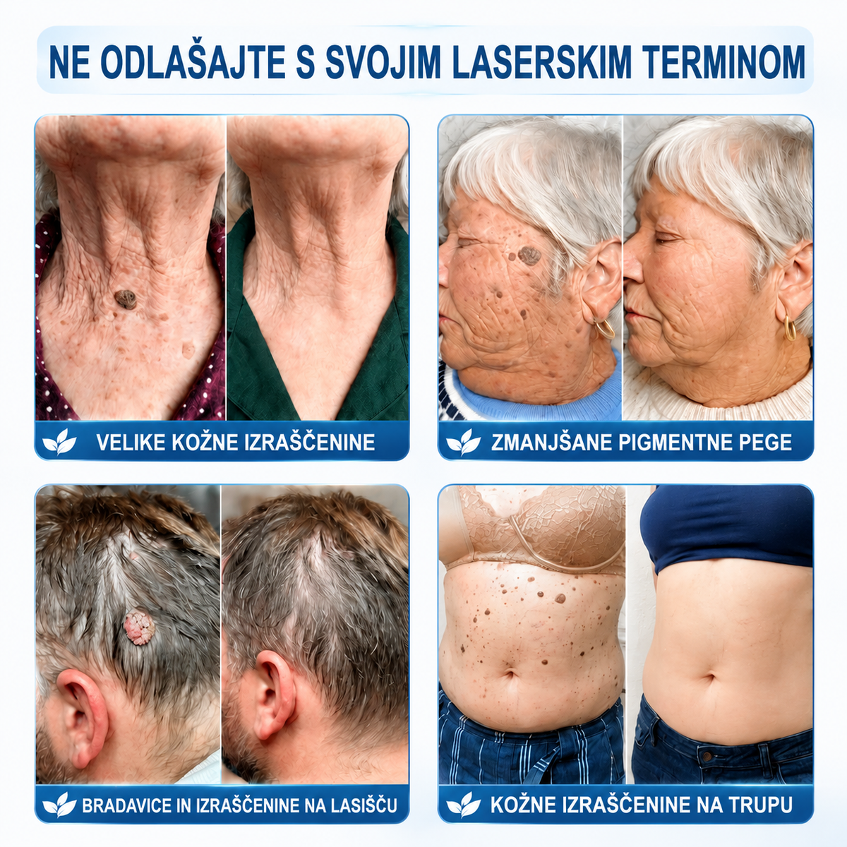 🥰Uradna trgovina|✅️👩‍⚕️𝐇𝐈𝐒𝐊𝐈𝐍®7 dnevni odstranjevalec kožnih izrastkov in madežev(𝐫𝐨𝐥𝐥-𝐨𝐧 𝐚𝐩𝐥𝐢𝐤𝐚𝐭𝐨𝐫: 𝐛𝐫𝐞𝐳 𝐛𝐨𝐥𝐞č𝐢𝐧 𝐢𝐧 𝐛𝐫𝐚𝐳𝐠𝐨𝐭𝐢𝐧)🌳