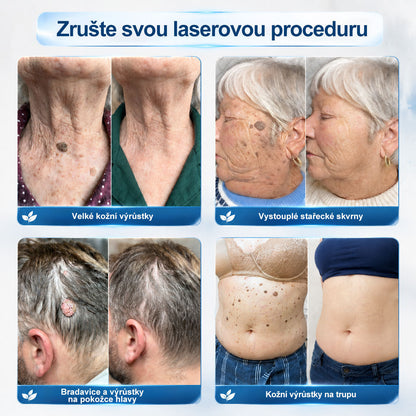 🥰Oficiální značkový obchod | Hiskin® 7denní odstraňovač skvrn a pigmentových skvrn (Bezbolestný rollerball bez jizev)🐬