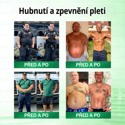 𝐆𝐞𝑒𝑙𝑒𝐦𝐨𝐧®🤞 Glum𝐚𝐬𝐞tide 8 v 1 – Zeštíhlující nano mikrojihlový náplast 🇨🇿 Jen 1× denně ✅ Viditelné změny za 7 dní – na obezitu, kardiovaskulární zdraví, diabetes a kloubní problémy