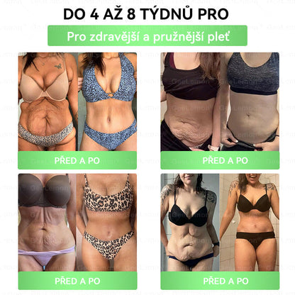 𝐆𝐞𝑒𝑙𝑒𝐦𝐨𝐧®🤞 Glum𝐚𝐬𝐞tide 8 v 1 – Zeštíhlující nano mikrojihlový náplast 🇨🇿 Jen 1× denně ✅ Viditelné změny za 7 dní – na obezitu, kardiovaskulární zdraví, diabetes a kloubní problémy