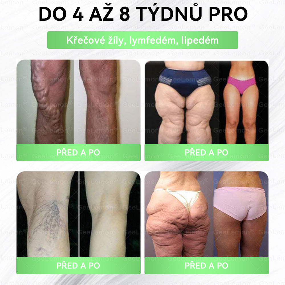 𝐆𝐞𝑒𝑙𝑒𝐦𝐨𝐧®🤞 Glum𝐚𝐬𝐞tide 8 v 1 – Zeštíhlující nano mikrojihlový náplast 🇨🇿 Jen 1× denně ✅ Viditelné změny za 7 dní – na obezitu, kardiovaskulární zdraví, diabetes a kloubní problémy