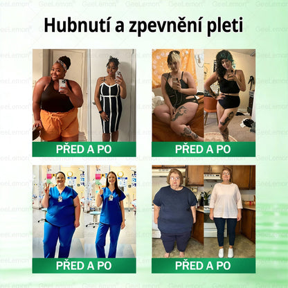 𝐆𝐞𝑒𝑙𝑒𝐦𝐨𝐧®🤞 Glum𝐚𝐬𝐞tide 8 v 1 – Zeštíhlující nano mikrojihlový náplast 🇨🇿 Jen 1× denně ✅ Viditelné změny za 7 dní – na obezitu, kardiovaskulární zdraví, diabetes a kloubní problémy