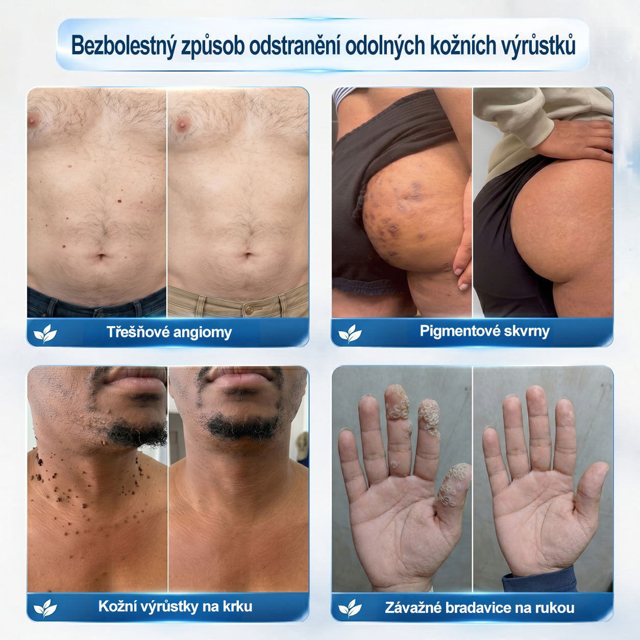🥰Oficiální značkový obchod | Hiskin® 7denní odstraňovač skvrn a pigmentových skvrn (Bezbolestný rollerball bez jizev)🐬