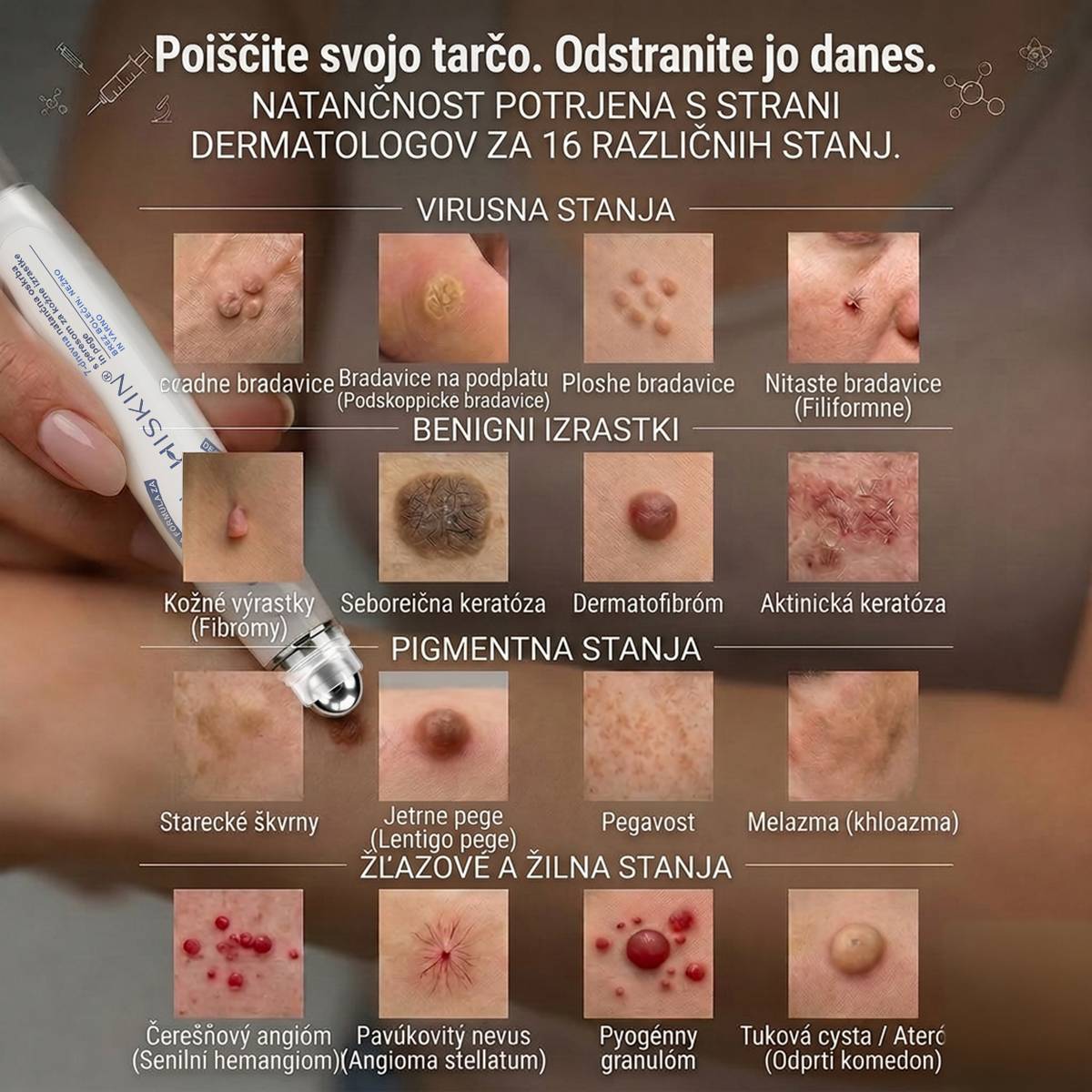 🥰Uradna trgovina|✅️👩‍⚕️𝐇𝐈𝐒𝐊𝐈𝐍®7 dnevni odstranjevalec kožnih izrastkov in madežev(𝐫𝐨𝐥𝐥-𝐨𝐧 𝐚𝐩𝐥𝐢𝐤𝐚𝐭𝐨𝐫: 𝐛𝐫𝐞𝐳 𝐛𝐨𝐥𝐞č𝐢𝐧 𝐢𝐧 𝐛𝐫𝐚𝐳𝐠𝐨𝐭𝐢𝐧)🌳