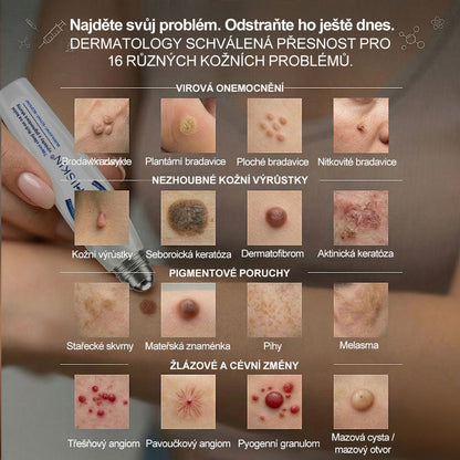 🥰Oficiální značkový obchod | Hiskin® 7denní odstraňovač skvrn a pigmentových skvrn (Bezbolestný rollerball bez jizev)🐬