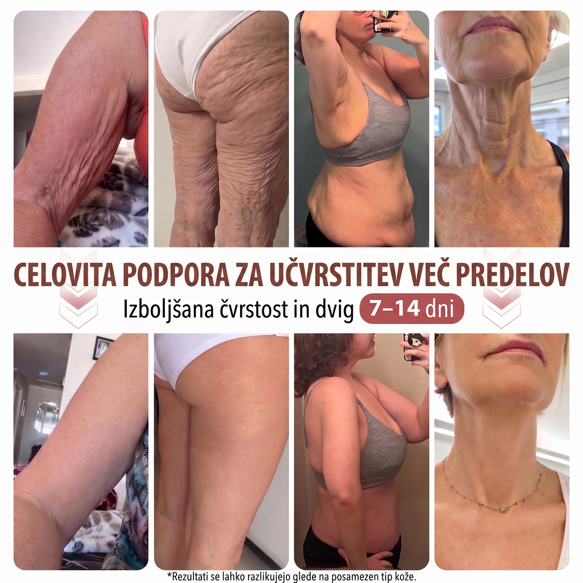 🐚HISKIN® MIKROIGLIČNI OBLIŽI ZA POVEČANJE, PRIVZDIG IN UČVRSTITEV PRSI